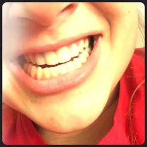 Teeth